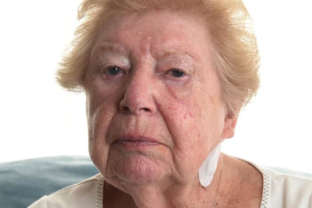Barbara needed treatment after having a bad reaction to antibiotics prescribed to her after an ear operation became infected