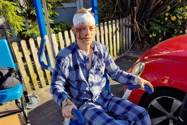 Owen Mayor suffered serious injuries in a hit-and-run collision in Fulwood
