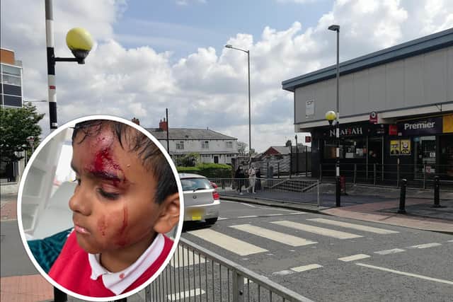 Talha Hussain (inset) pictured after a serious accident on a notorious zebra crossing on Manchester Road last year