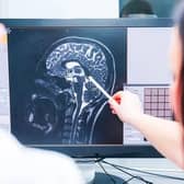 Medical imaging technology has changed health care over the last few years. Photo: Shutterstock