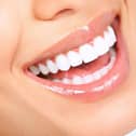 My daughter has perfect teeth thanks to my nagging. Photo: Adobe