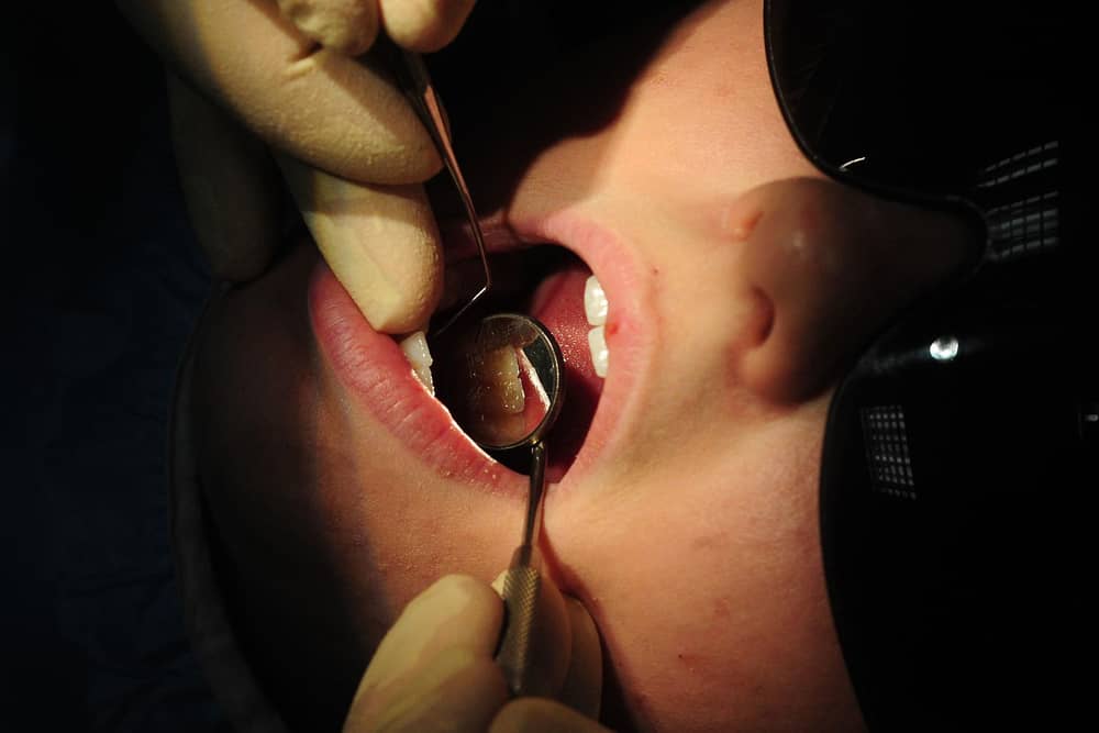 Calls for emergency dental register as 54% of kids in Blackpool miss dental check up