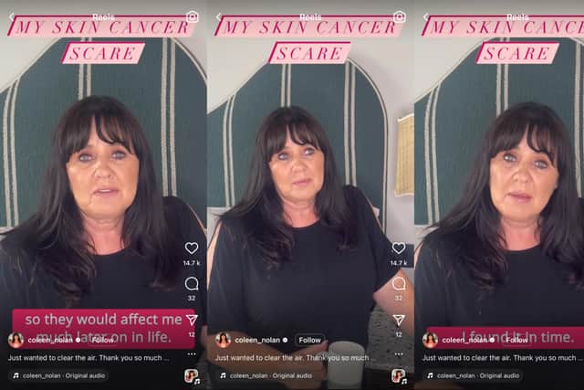 The 58-year-old ITV panellist addressed her 339k Instagram fans to “clear the air”  about her experience (Credit: @coleen_nolan)