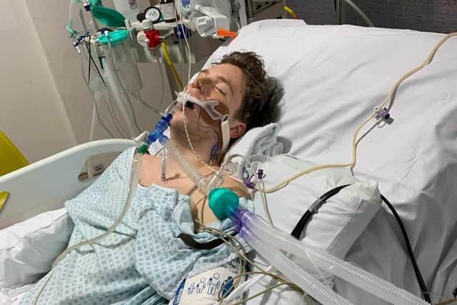 Doctors only gave Jordan a 50 percent chance of survival after he suffered catastrophic injuries when he was knocked off his bike in a road accident in London in 2020