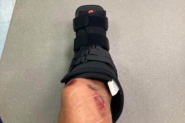 Jane Shorrock suffered a broken ankle after she was run over by a mobility scooter in Market Street, Chorley on Friday, September 2