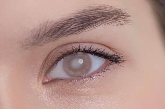 Corneal diseases have a huge impact on individuals and their families