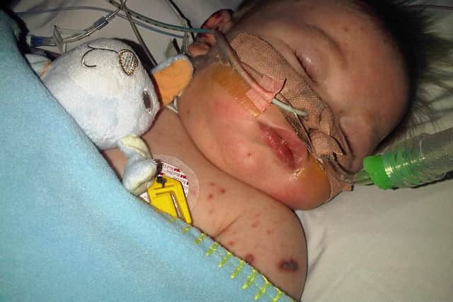 Adam when he was a baby and had been seriously ill with meningitis