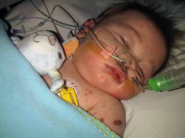 Adam when he was a baby and had been seriously ill with meningitis