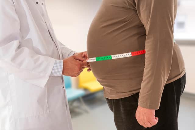 Doctor measuring obese man's waist body fat. (File picture)