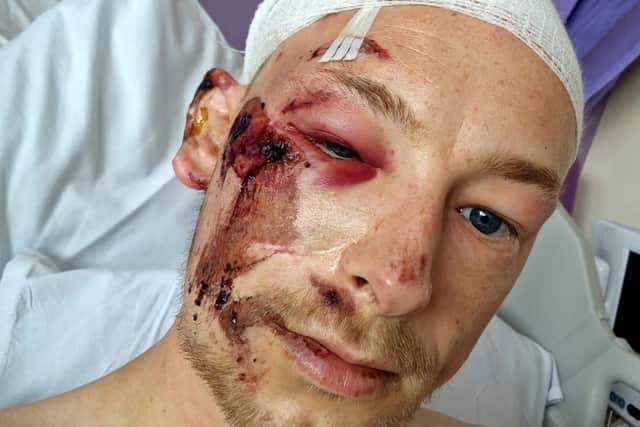 Owen was cycling along Blackpool Road when he was struck from behind by a motorcyclist