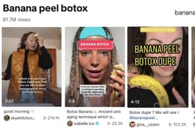 Banana Peel Botox TikTok Views