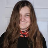 Matt Roberts hair growth after three years.