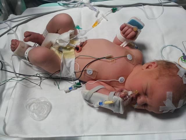 Jayden Astley sustained a brain injury at birth in July 2012 due to errors attributed to midwives at Royal Preston Hospital. Now aged 11, he faces ongoing challenges including deafness, motor impairments, cognitive and behavioural difficulties. (Picture courtesy of the Astley family)