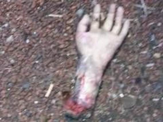 Officers found a gruesome-looking bloody hand