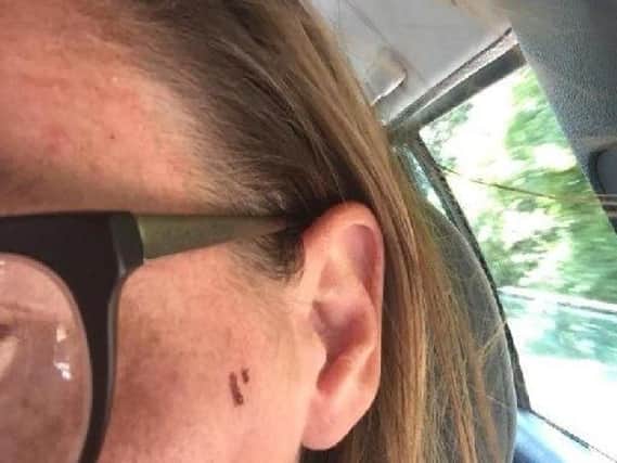 Clare Hughes suffered a cut to her face during the incident
