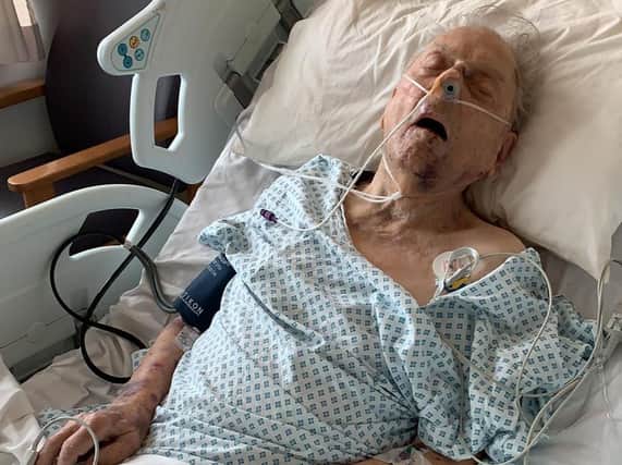 Peter Gouldstone in a hospitial bed after he was attacked and robbed in his own home. Photo credit: Metropolitian Police/PA Wire