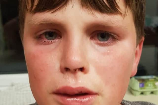Luca Stevenson, 11, was allegedly attacked in a park whilst out playing in Longton, Preston on Saturday, November 24.