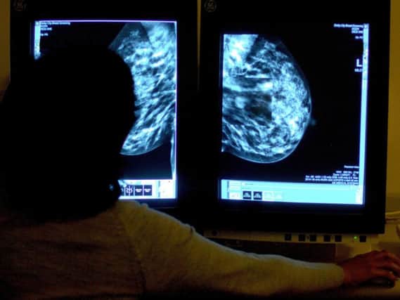 Just 68.5 per cent of women in Preston due a breast screening took up the offer