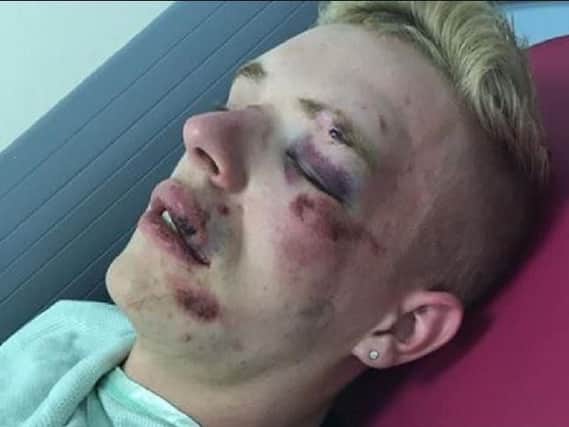 Ryan Williams, 22, was attacked near McDonald's in Friargate, Preston, Saturday, July 13. Pic credit: Ryan Williams