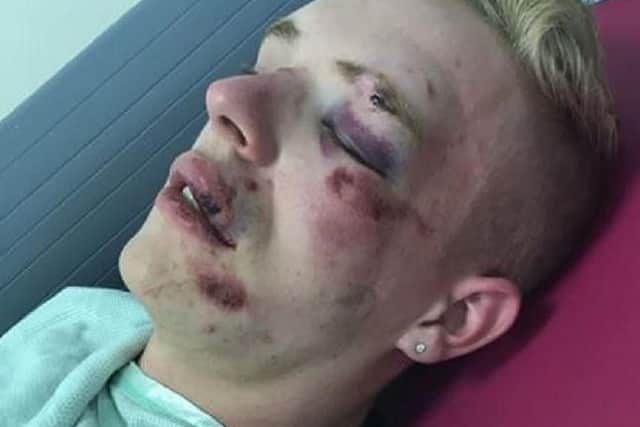 Ryan Williams, 22, was attacked near McDonald's in Friargate, Preston, Saturday, July 13. Pic credit: Ryan Williams