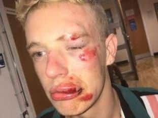 Ryan was punched in the head, knocked unconscious and kicked in the face after his assailants verbally abused him for being gay. Pic credit: Ryan Williams