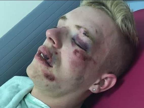 Ryan Williams, 22, was attacked near McDonald's in Friargate, Preston, Saturday, July 13. Pic credit: Ryan Williams