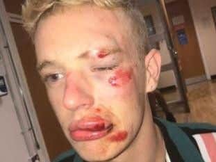 Stonewall has condemned the "horrific attack" on Ryan Williams and says more needs to be done to protect the LGBT community Pic: Ryan Williams