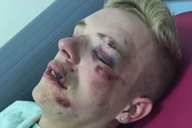 Ryan Williams, 22, was attacked near McDonald's in Friargate, Preston on Saturday, July 13. Pic credit: Ryan Williams