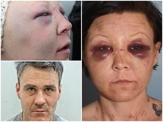 Pictured top left and right, Gemma Griffin's injuries. Bottom left, Kelvin Cornwell