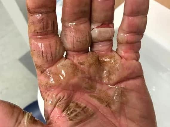 JTF customer Helen Shelton said her father suffered serious burns after a Turbo Sparkler exploded in his hand on Sunday (November 3) Pic: Helen Shelton