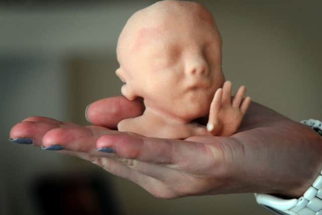 Baby:Boo 3D and 4D baby scans in Tarleton. near Preston
A 3D print of a scan