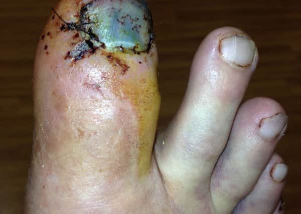 Matthew Heys: injured toe