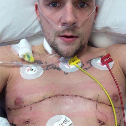 Photo Neil CrossKieran Miller, 27, who has cystic fibrosis, celebrating two years since his double lung transplant
