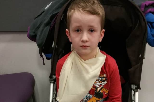 Six-year-old Owen Parker with the temporary cast on his leg, which was injured after a gate fell on him at Williamson Park in Lancaster.