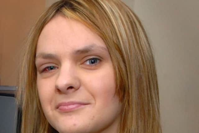 Stab victim Jessica Knight. Pictured one year after the attack