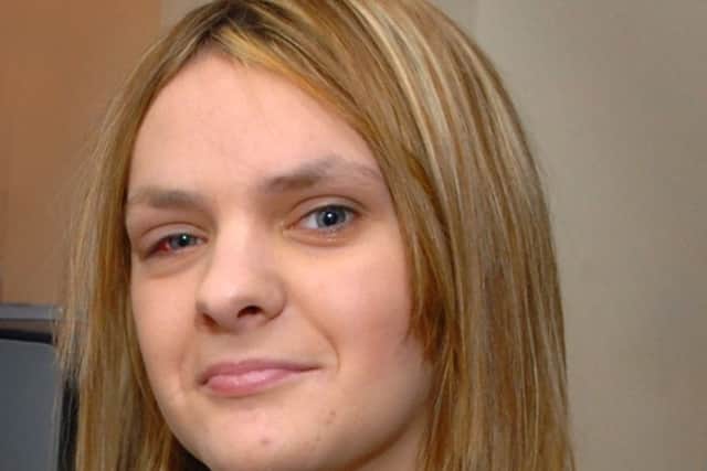 Stab victim Jessica Knight. Pictured one year after the attack