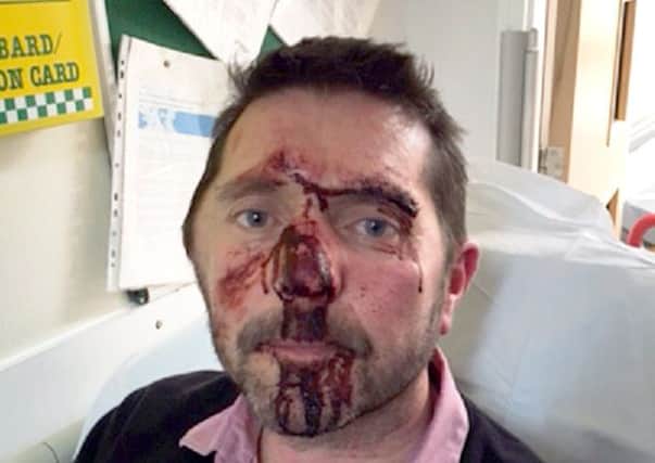 Thomas Graham, injured in street attack in Chorley