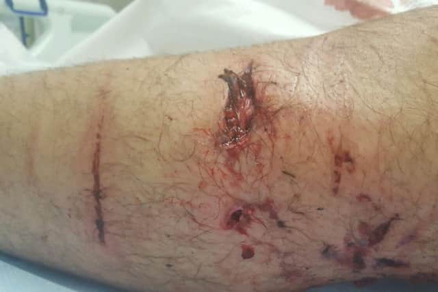 Dominic Pemberton, 23, from Chorley was attacked by a Greater Manchester Police dog.