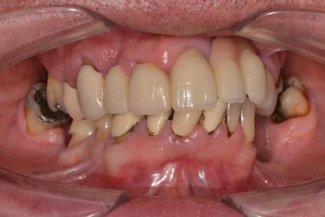 Richard Ogden's teeth