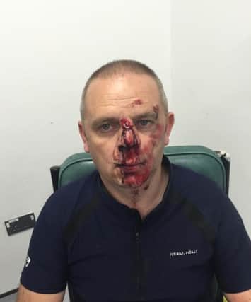 Adrian Smith, 43, of Longridge, was knocked off his bike in Ribbleton Lane, Preston