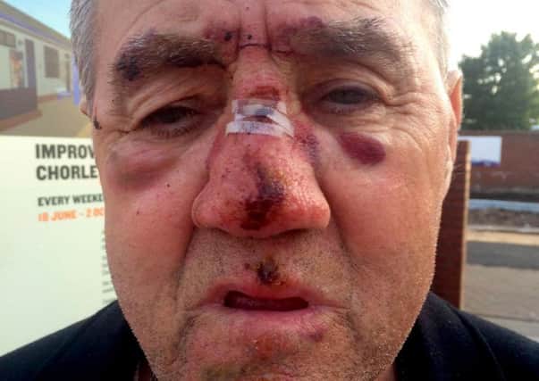 Injured: John Hall after being attacked in a Chorley pub