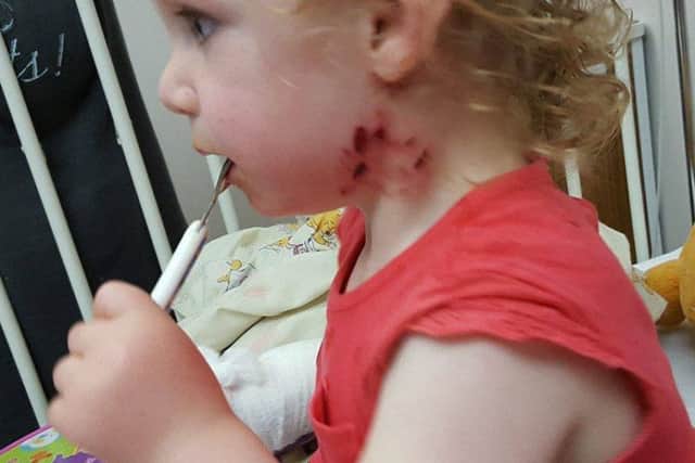 Little Abbey Deegan in hospital after the dog attack.
