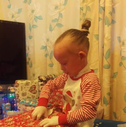 Michelle Alder's daughter Keira, 6, has severe atopic eczema, which means she has to wear full-body bandages 24 hours a day.