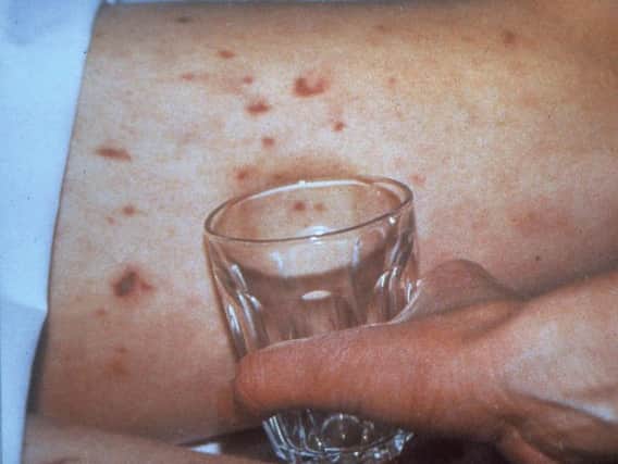 Students are being urged to get vaccinated before they return to university