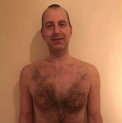 Nick Tofalos, principal ofGarstang Osteopathic Clinic, had the hair waxed from his chest to support his long-term patient and friend Luke Carter.