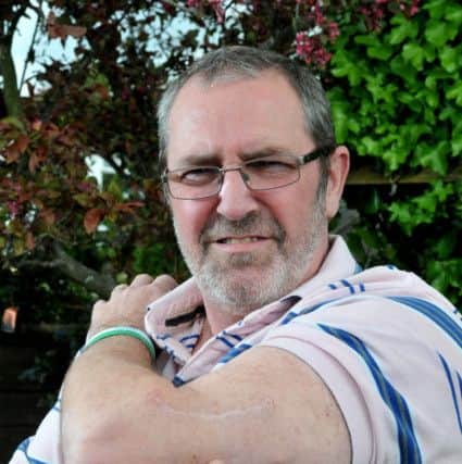 Photo Neil Cross
Dave Fairclough, 57, is having a new treatment for skin cancer which involves being injected with herpes