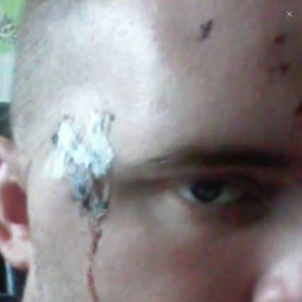 Shane King, from Bamber Bridge, was attacked with by a bottle in Skelmersdale