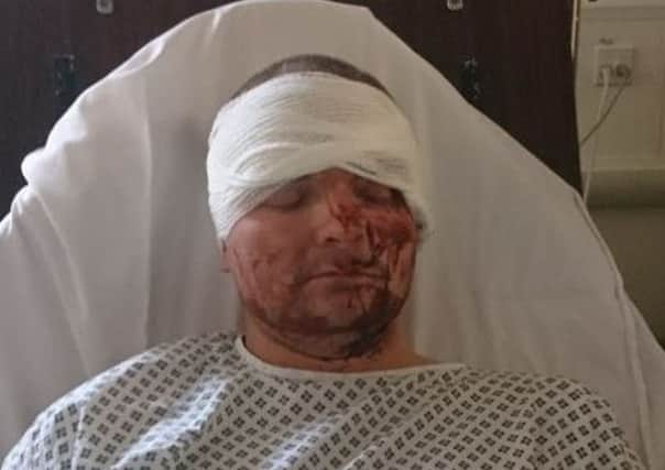 Shane King, 23, from Bamber Bridge was attacked by four teenage girls in Skelmersdale.
