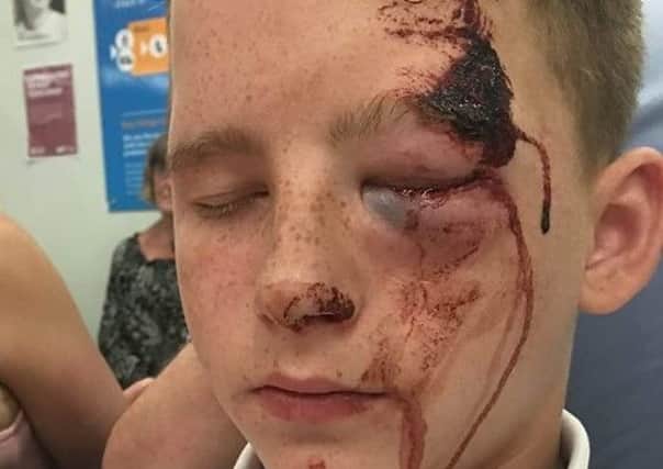 A mum is appealing for witnesses to come forward after her son was beaten by a man.