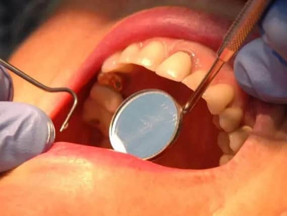 25 per cent of under 5s with tooth decay
